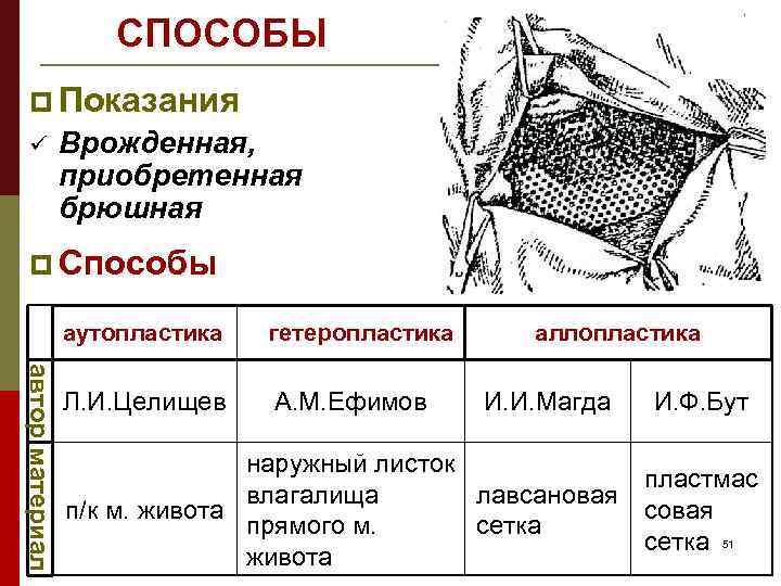 СПОСОБЫ p Показания ü Врожденная, приобретенная брюшная p Способы автор материал аутопластика гетеропластика Л.