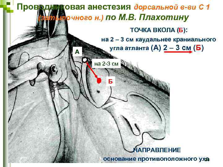 Проводниковая анестезия дорсальной в-ви C 1 (затылочного н. ) по М. В. Плахотину А