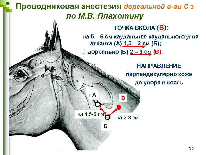 Проводниковая анестезия дорсальной в-ви C 3 по М. В. Плахотину ТОЧКА ВКОЛА (В): на