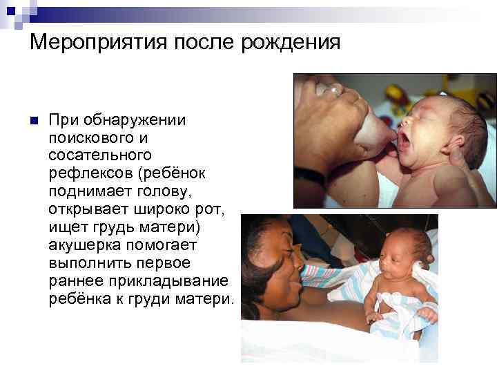 Мероприятия после рождения n При обнаружении поискового и сосательного рефлексов (ребёнок поднимает голову, открывает