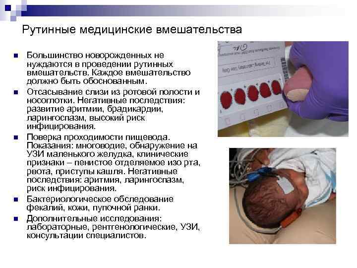 Рутинные медицинские вмешательства n n n Большинство новорожденных не нуждаются в проведении рутинных вмешательств.