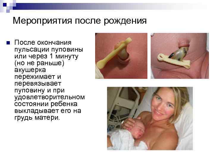 Мероприятия после рождения n После окончания пульсации пуповины или через 1 минуту (но не