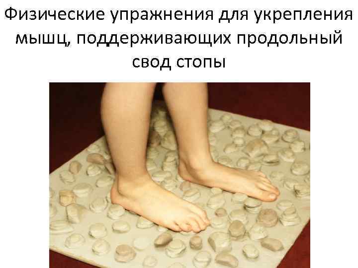 Физические упражнения для укрепления мышц, поддерживающих продольный свод стопы 