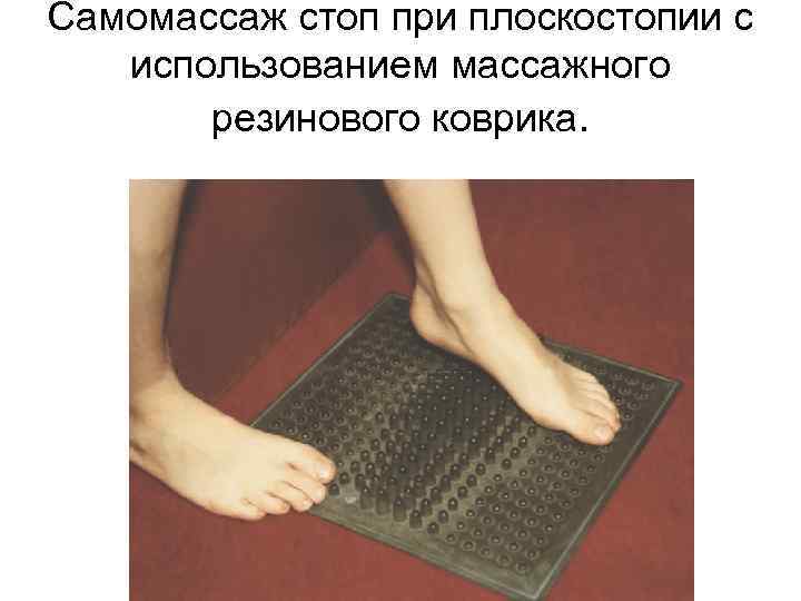 Самомассаж стоп при плоскостопии с использованием массажного резинового коврика. 