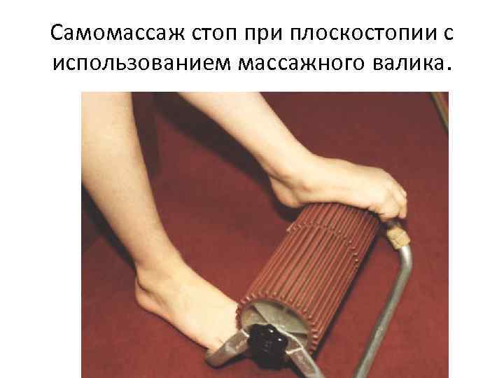 Самомассаж стоп при плоскостопии с использованием массажного валика. 