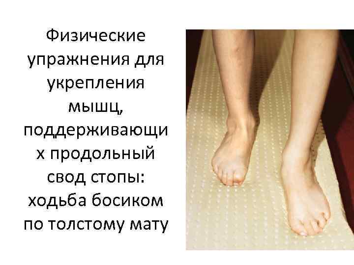 Физические упражнения для укрепления мышц, поддерживающи х продольный свод стопы: ходьба босиком по толстому