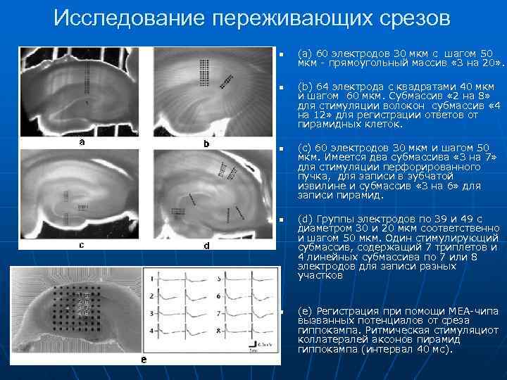 Исследование переживающих срезов n n n (a) 60 электродов 30 мкм с шагом 50