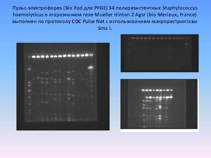 Пульс-электрофорез (Bio Rad для PFGE) 34 полирезистентных Staphylococcys haemolyticus в агарозномом геле Mueller Hinton