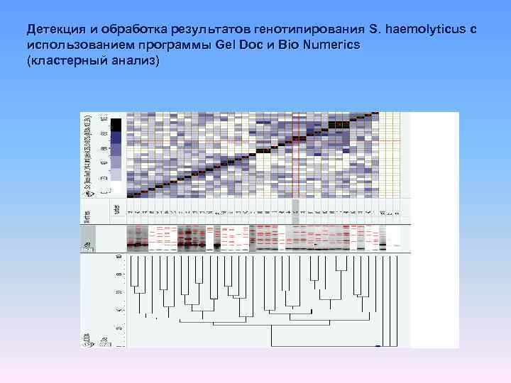 Детекция и обработка результатов генотипирования S. haemolyticus с использованием программы Gel Doc и Bio