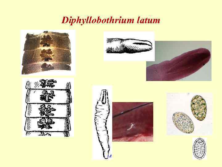 Diphyllobothrium latum 
