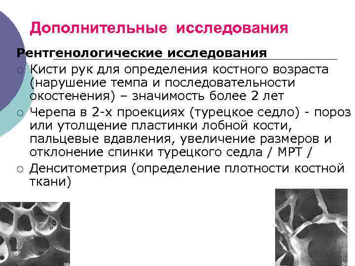 Дополнительные исследования Рентгенологические исследования ¡ Кисти рук для определения костного возраста (нарушение темпа и
