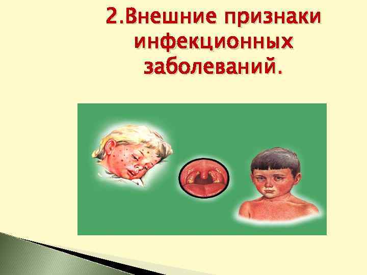 2. Внешние признаки инфекционных заболеваний. 