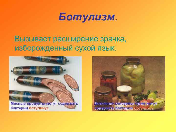 Ботулизм. Вызывает расширение зрачка, изборожденный сухой язык. 