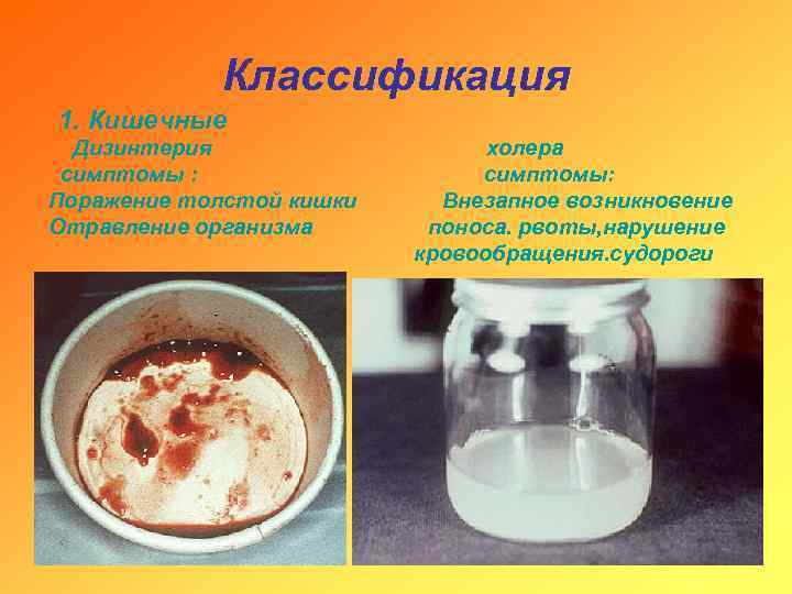 Классификация 1. Кишечные Дизинтерия симптомы : Поражение толстой кишки Отравление организма холера симптомы: Внезапное