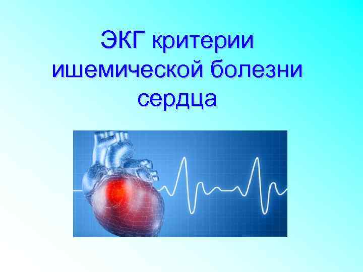 ЭКГ критерии ишемической болезни сердца 