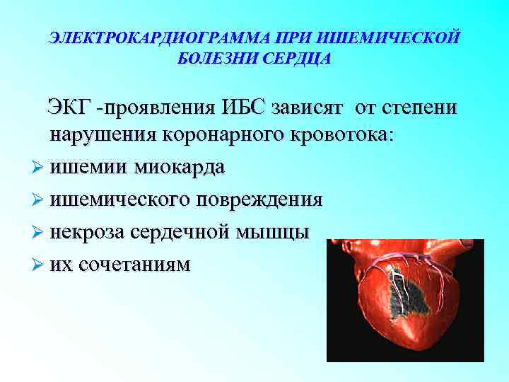ЭЛЕКТРОКАРДИОГРАММА ПРИ ИШЕМИЧЕСКОЙ БОЛЕЗНИ СЕРДЦА ЭКГ -проявления ИБС зависят от степени нарушения коронарного кровотока: