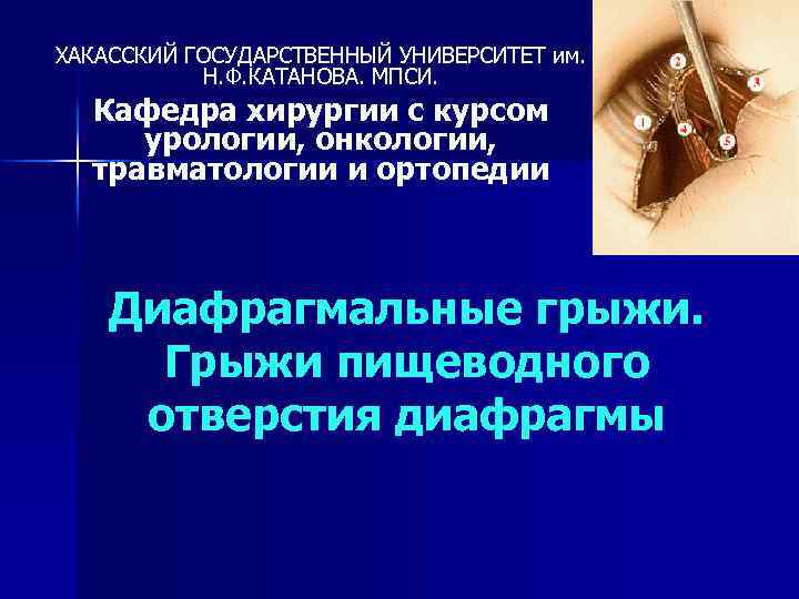 ХАКАССКИЙ ГОСУДАРСТВЕННЫЙ УНИВЕРСИТЕТ им. Н. Ф. КАТАНОВА. МПСИ. Кафедра хирургии с курсом урологии, онкологии,