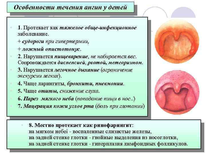 Характерной особенностью клинической картины ангины людвига является