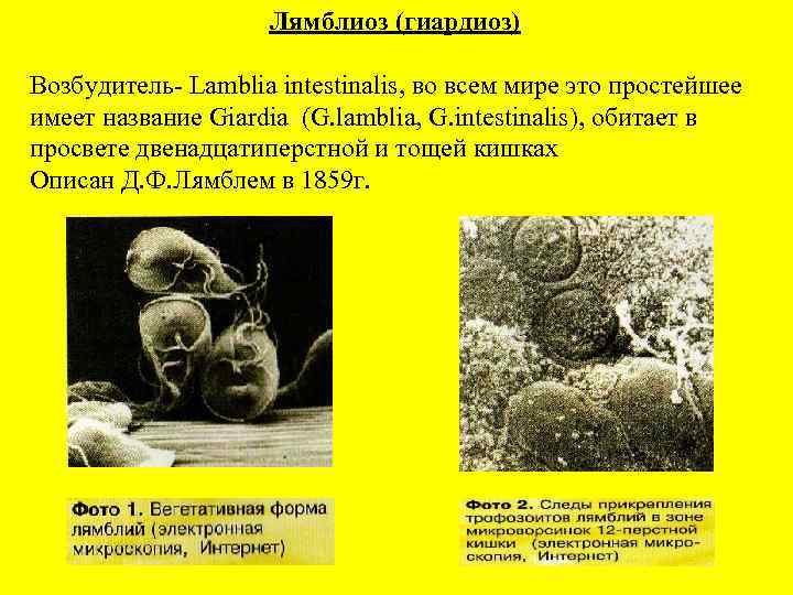 Лямблиоз (гиардиоз) Возбудитель- Lamblia intestinalis, во всем мире это простейшее имеет название Giardia (G.