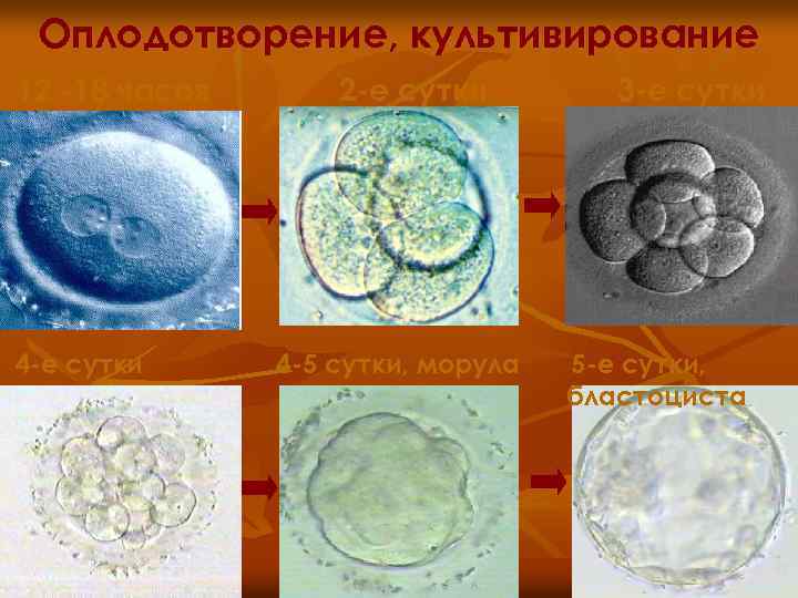 Оплодотворение, культивирование 12 -18 часов 4 -е сутки 2 -е сутки 4 -5 сутки,