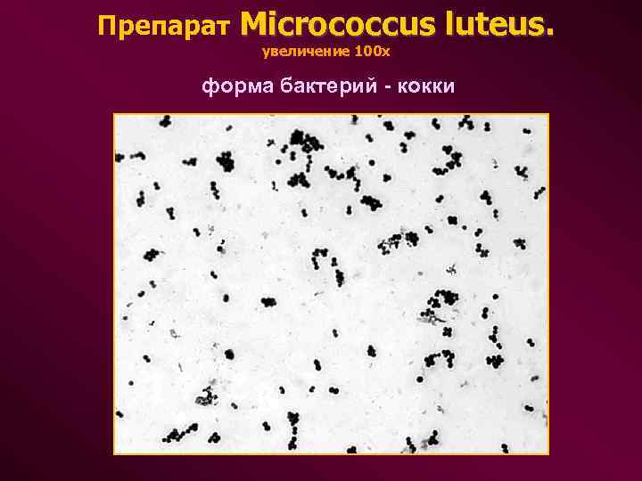 Препарат Micrococcus luteus. увеличение 100 х форма бактерий - кокки 