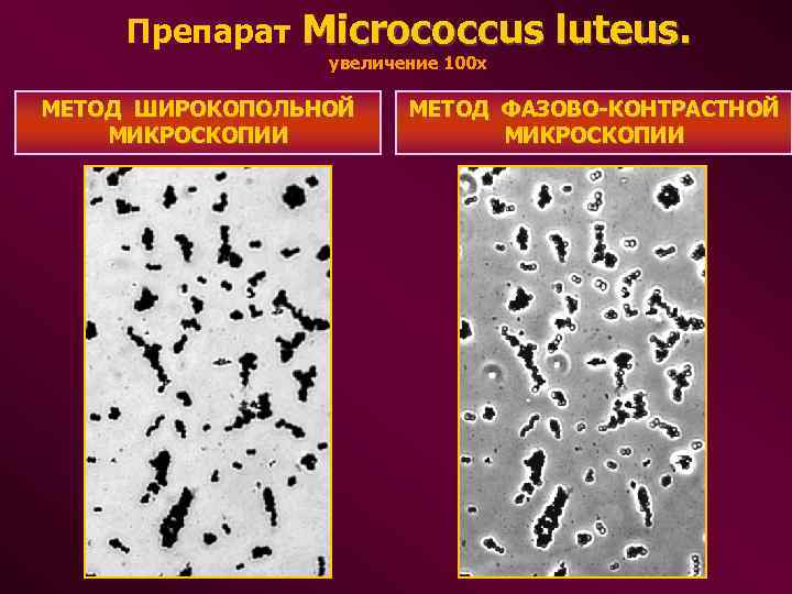  Препарат Micrococcus luteus. увеличение 100 х МЕТОД ШИРОКОПОЛЬНОЙ МЕТОД ФАЗОВО-КОНТРАСТНОЙ МИКРОСКОПИИ МИКРОСКОПИИ 