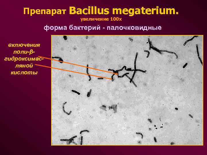  Препарат Bacillus megaterium. увеличение 100 х форма бактерий - палочковидные включения поли-β- гидроксимас-