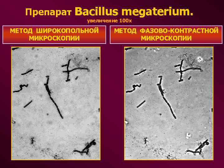  Препарат Bacillus megaterium. увеличение 100 х МЕТОД ШИРОКОПОЛЬНОЙ МЕТОД ФАЗОВО-КОНТРАСТНОЙ МИКРОСКОПИИ МИКРОСКОПИИ 