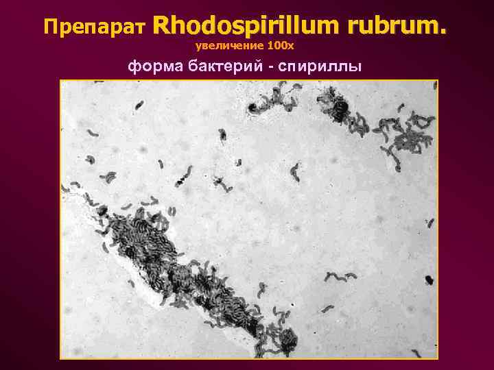 Препарат Rhodospirillum rubrum. увеличение 100 х форма бактерий - спириллы 