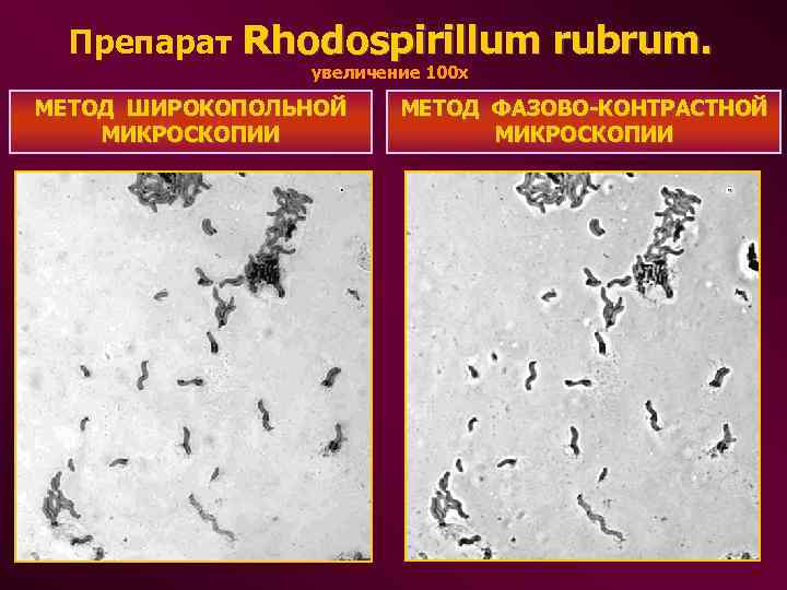  Препарат Rhodospirillum rubrum. увеличение 100 х МЕТОД ШИРОКОПОЛЬНОЙ МЕТОД ФАЗОВО-КОНТРАСТНОЙ МИКРОСКОПИИ МИКРОСКОПИИ 