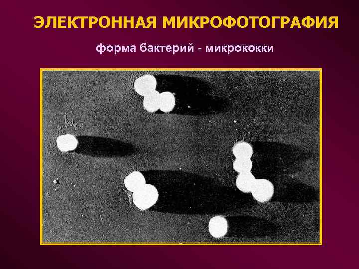 ЭЛЕКТРОННАЯ МИКРОФОТОГРАФИЯ форма бактерий - микрококки 