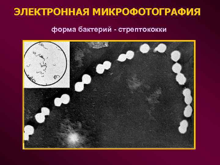 ЭЛЕКТРОННАЯ МИКРОФОТОГРАФИЯ форма бактерий - стрептококки 