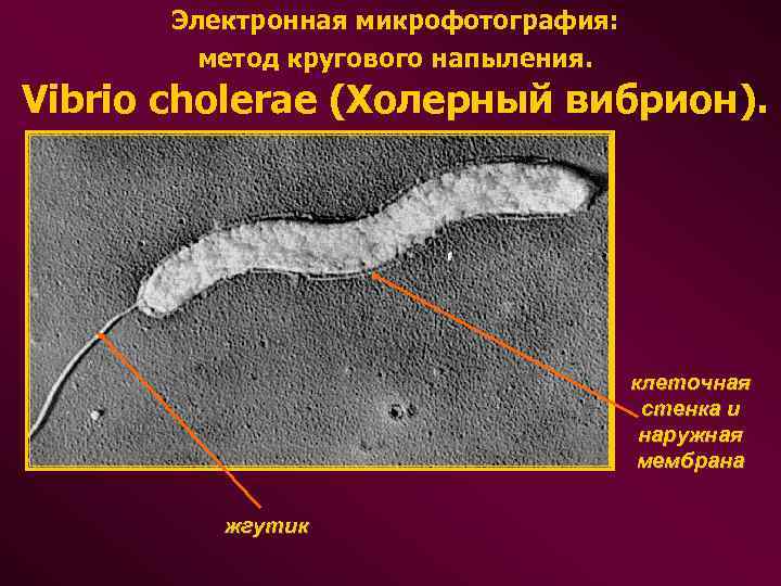  Электронная микрофотография: метод кругового напыления. Vibrio cholerae (Холерный вибрион). клеточная стенка и наружная