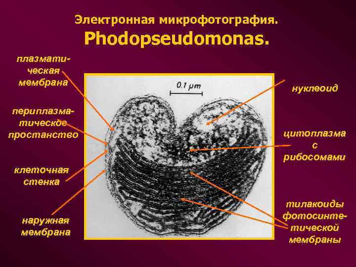  Электронная микрофотография. Phodopseudomonas. плазмати- ческая мембрана нуклеоид периплазма- тическое простанство цитоплазма с рибосомами