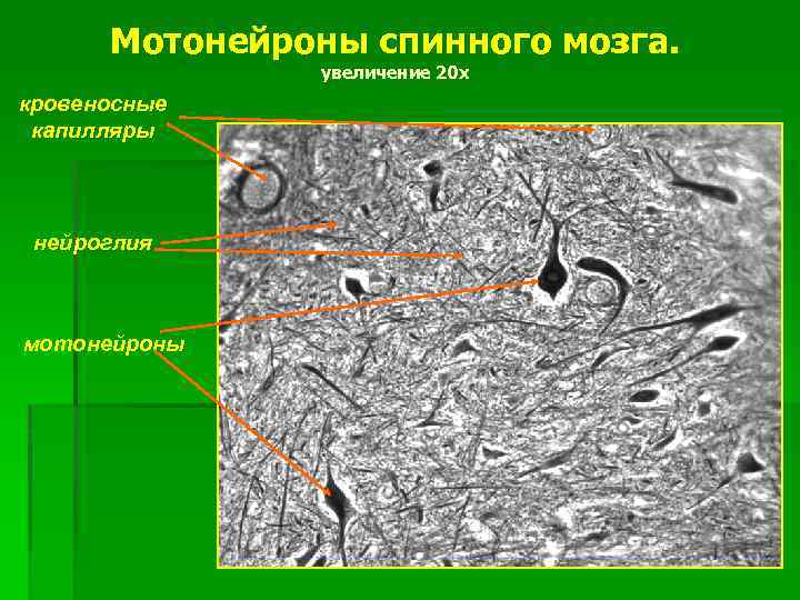 Мотонейроны спинного мозга. увеличение 20 х кровеносные капилляры нейроглия мотонейроны 