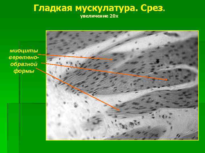 Гладкая мускулатура. Срез. увеличение 20 х миоциты веретенообразной формы 