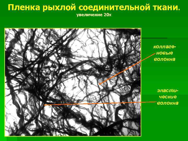 Пленка рыхлой соединительной ткани. увеличение 20 х коллагеновые волокна эластические волокна 