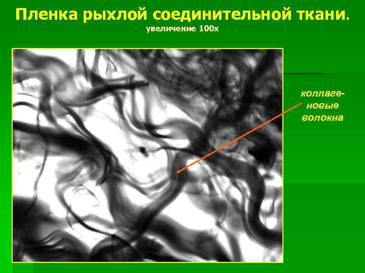 Пленка рыхлой соединительной ткани. увеличение 100 х коллагеновые волокна 
