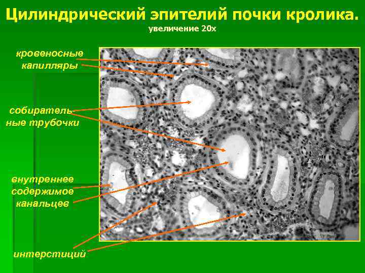 Цилиндрический эпителий почки кролика. увеличение 20 х кровеносные капилляры собирательные трубочки внутреннее содержимое канальцев