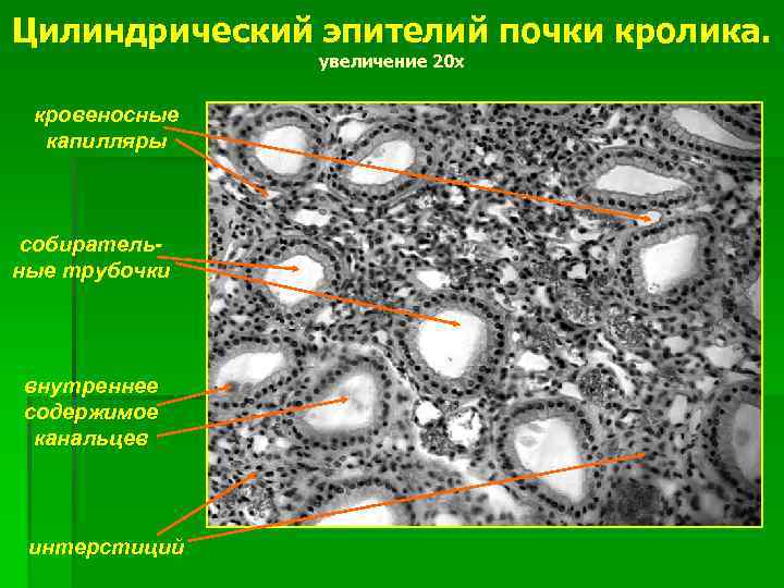 Цилиндрический эпителий почки кролика. увеличение 20 х кровеносные капилляры собирательные трубочки внутреннее содержимое канальцев
