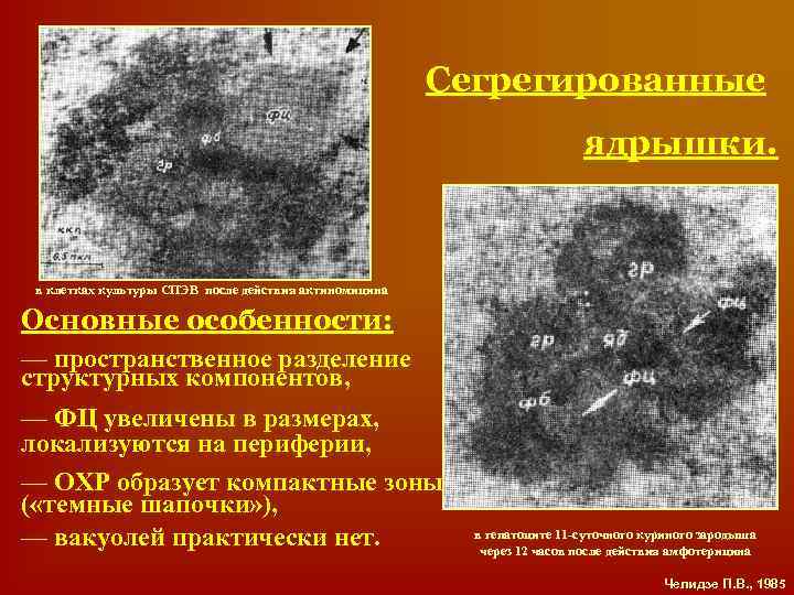 Сегрегированные ядрышки. в клетках культуры СПЭВ после действия актиномицина Основные особенности: — пространственное разделение