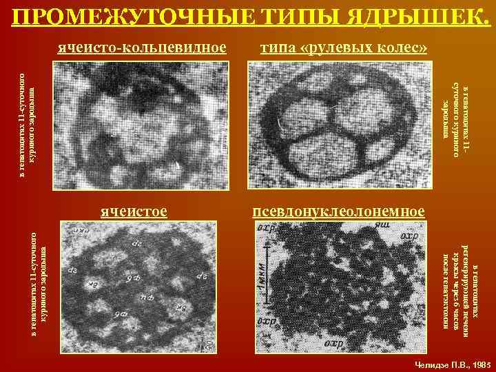 псевдонуклеолонемное ячеистое типа «рулевых колес» ячеисто-кольцевидное в гепатоцитах регенерирующей печени крысы через 6 часов