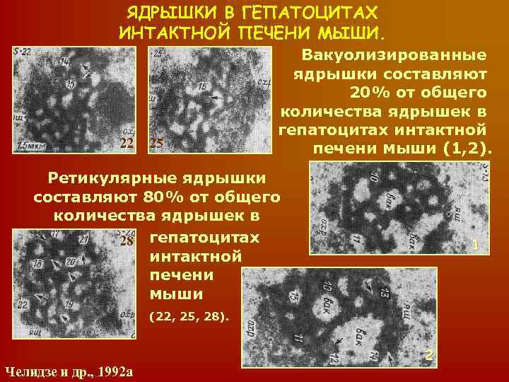 ЯДРЫШКИ В ГЕПАТОЦИТАХ ИНТАКТНОЙ ПЕЧЕНИ МЫШИ. 22 25 Вакуолизированные ядрышки составляют 20% от общего