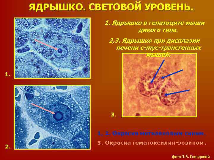 ЯДРЫШКО. СВЕТОВОЙ УРОВЕНЬ. 1. Ядрышко в гепатоците мыши дикого типа. 2, 3. Ядрышко при