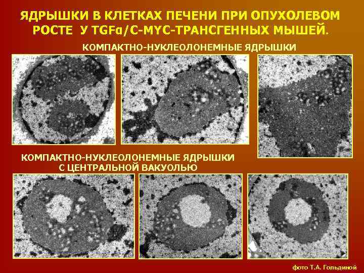 ЯДРЫШКИ В КЛЕТКАХ ПЕЧЕНИ ПРИ ОПУХОЛЕВОМ РОСТЕ У TGFα/C-MYC-ТРАНСГЕННЫХ МЫШЕЙ. КОМПАКТНО-НУКЛЕОЛОНЕМНЫЕ ЯДРЫШКИ С ЦЕНТРАЛЬНОЙ