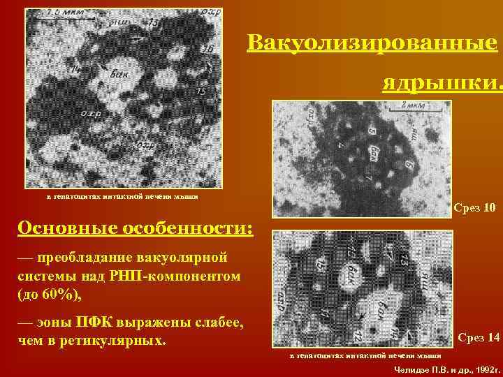 Вакуолизированные ядрышки. в гепатоцитах интактной печени мыши Срез 10 Основные особенности: — преобладание вакуолярной