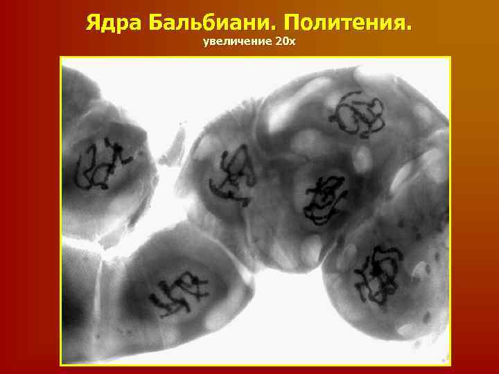Ядра Бальбиани. Политения. увеличение 20 х 