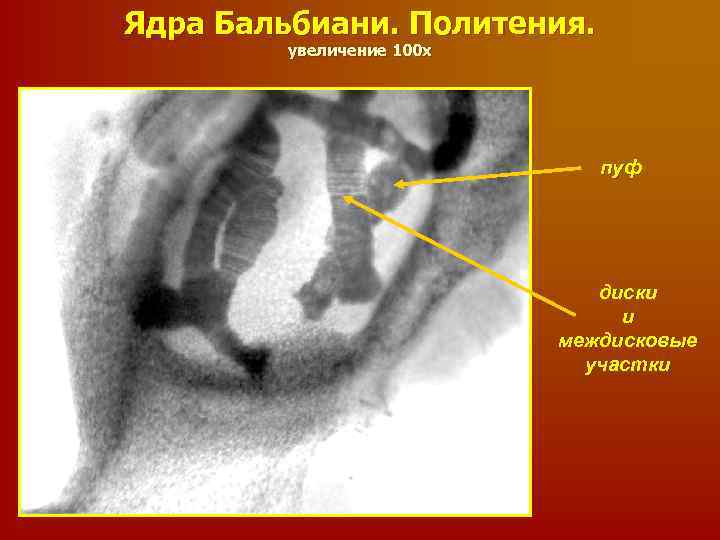 Ядра Бальбиани. Политения. увеличение 100 х пуф диски и междисковые участки 
