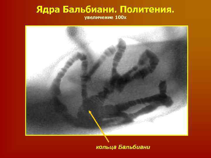 Ядра Бальбиани. Политения. увеличение 100 х кольца Бальбиани 