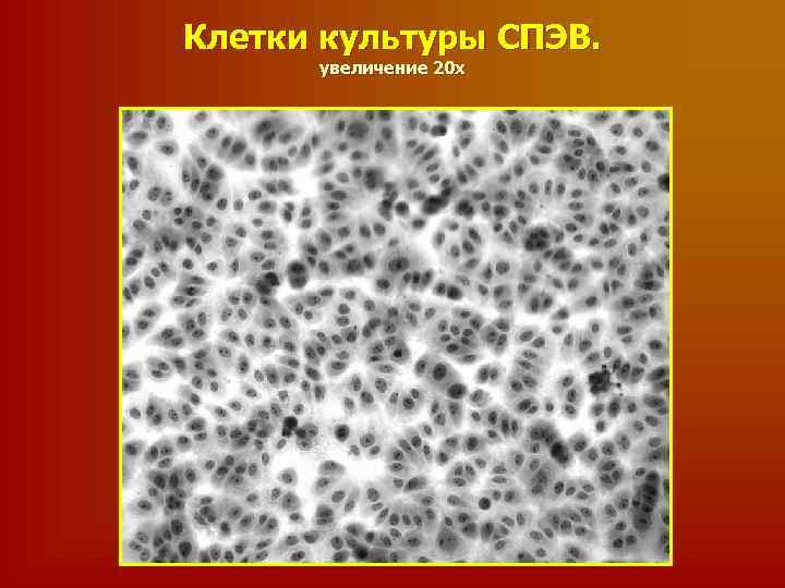 Увеличение 20. СПЭВ клеточная культура. Клетки СПЭВ. Клетки культуры СПЭВ световой микроскоп. Ядро световая микроскопия.